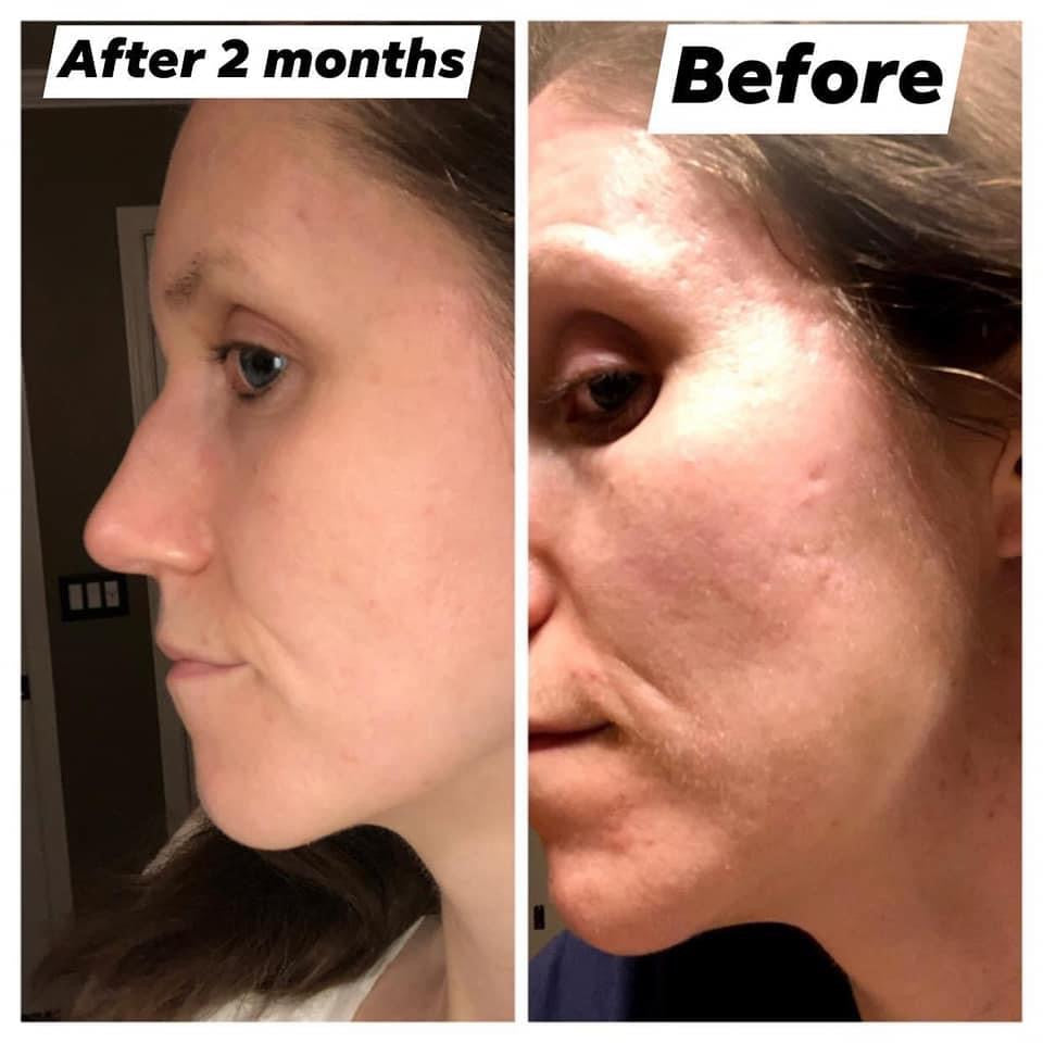 Ageloc Lumispa
