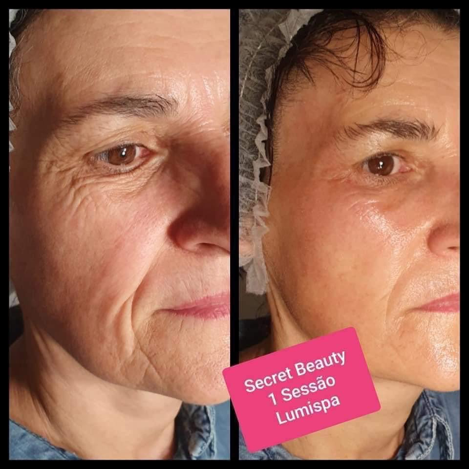 Ageloc Lumispa