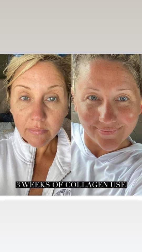 Collagen Plus