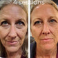 Facial Spa (AKA Wrinkle Iron)